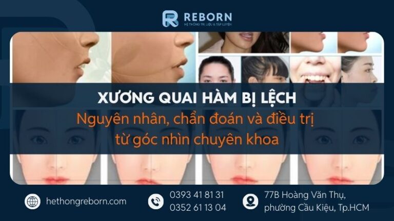Xương quai hàm bị lệch: Nguyên nhân, chẩn đoán và điều trị từ góc nhìn chuyên khoa