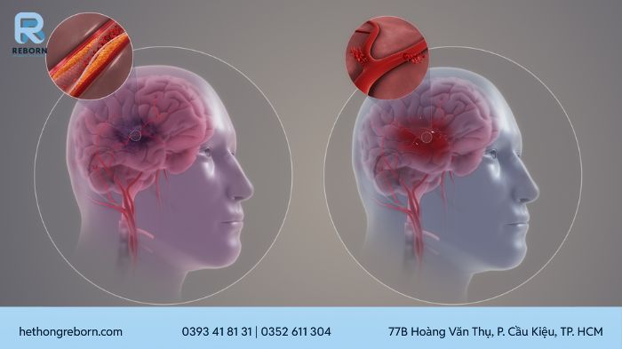 Tác Dụng Phụ Của Thuốc
