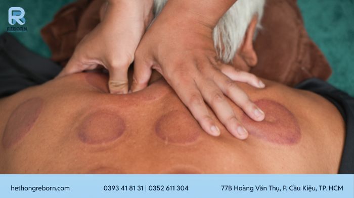Vật Lý Trị Liệu Y Học Cổ Truyền