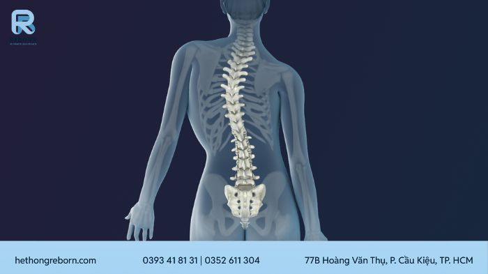 vẹo cột sống
